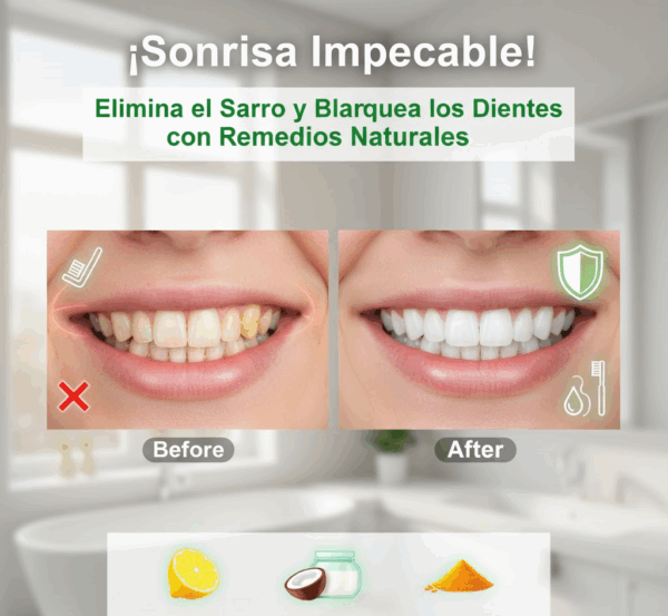 Elimina el Sarro y Blanquea los Dientes con Remedios Naturales